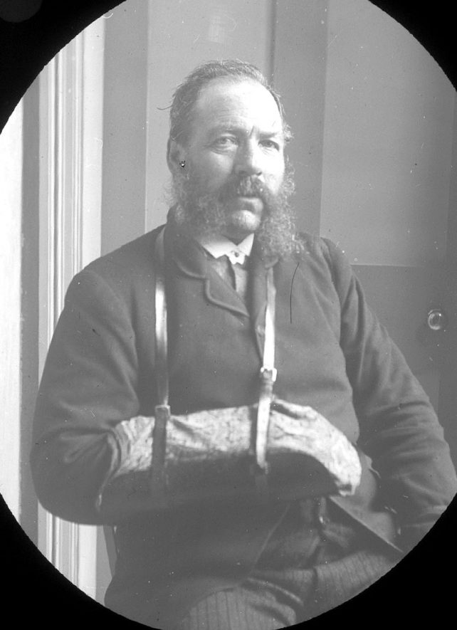 Mr Crossley with arm in sling, Clifford Chambers.  1900s |  IMAGE LOCATION: (Warwickshire County Record Office) PEOPLE IN PHOTO: Crossley, Mr, Crossley as a surname