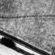 Double pit alignment, E of Coalpit Lane