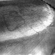 Site of Roman Settlement 500m W of Welford Church